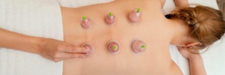 woman-experiencing-cupping-therapy